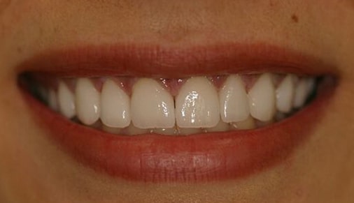 amazing dental transformation