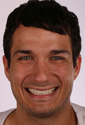Man with new smile after cosmetic dentistry