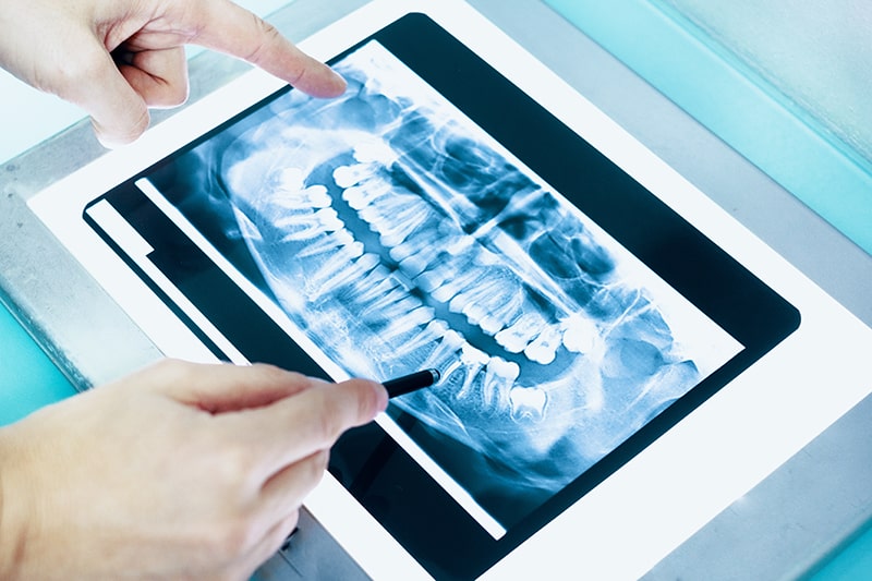 a dentist inspecting a digital x-ray of a patient
