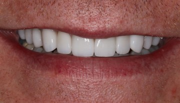 amazing dental transformation